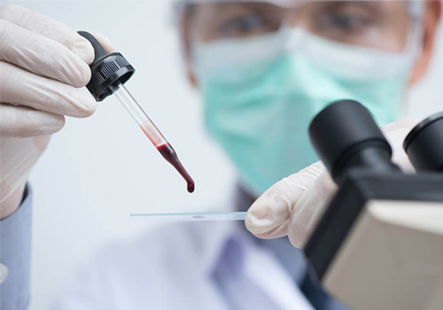 Blood Group