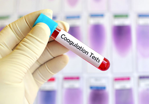 Coagulation Profile