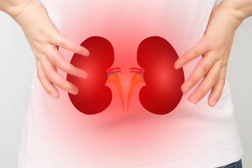 Kidney Disease