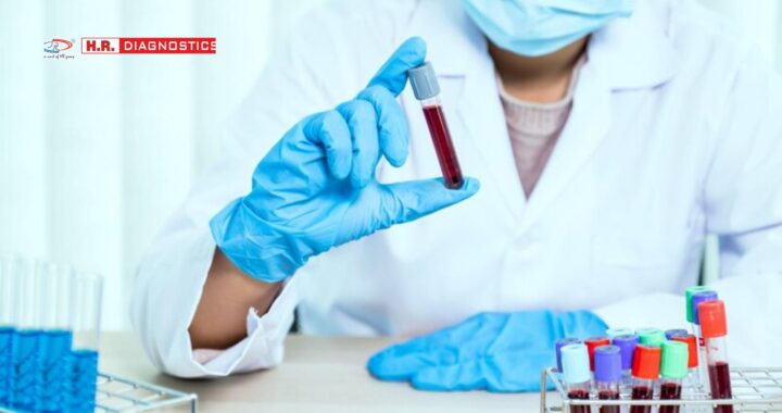 Find the Best Blood Test Lab Near Me | H.R. Diagnostic