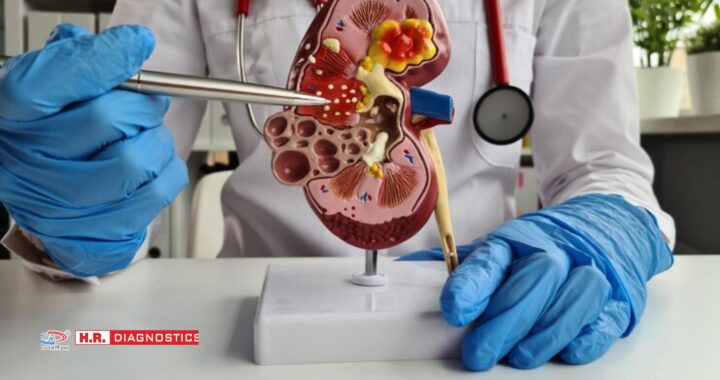 Top Kidney Function Tests | Urine Tests & Home Checking Guide