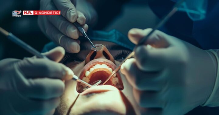 Comprehensive Guide to Root Canal Procedure at H.R. Diagnostic