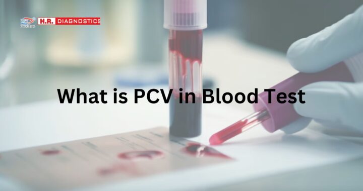 What is PCV in Blood Test | PDW Blood Test, Dengue, Home Collection