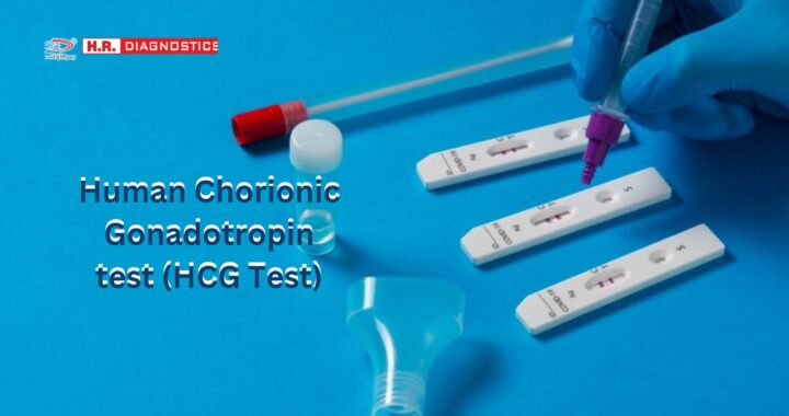 Chorionic Gonadotropin Test: Importance, Procedure, and Benefits