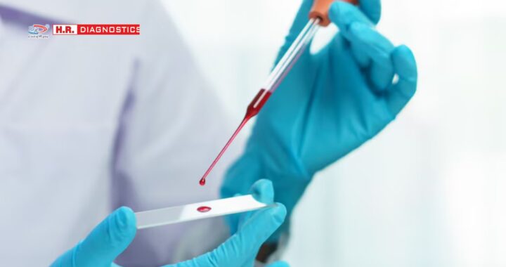 Complete Blood Test – Comprehensive Analysis & Benefits at H.R. Diagnostic