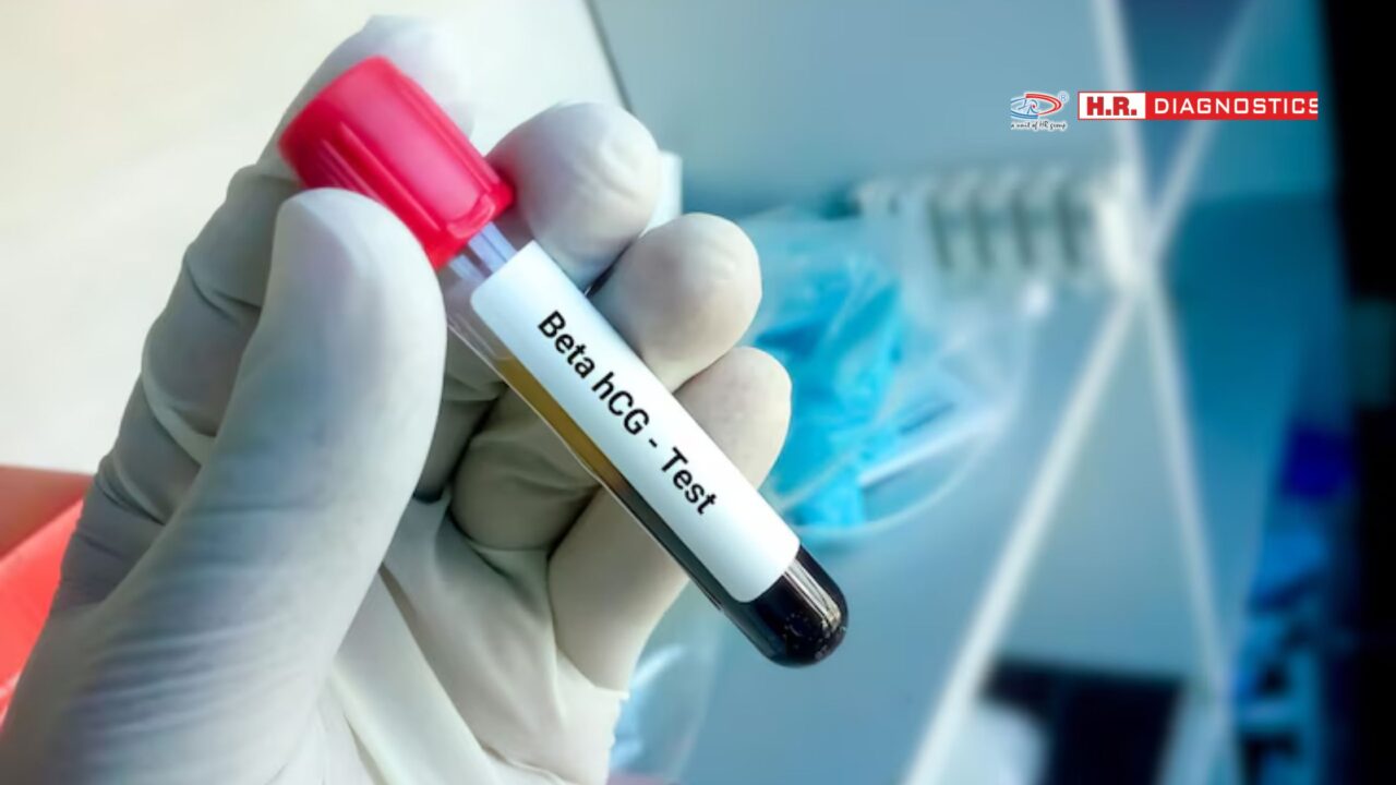 HCG Test Near Me for Accurate Results