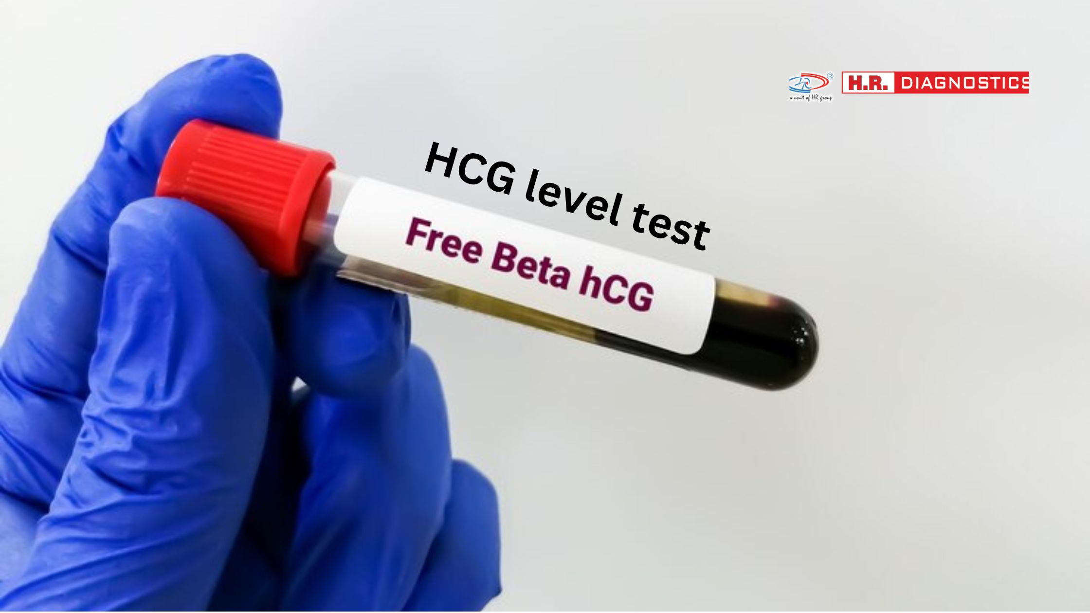 HCG level test