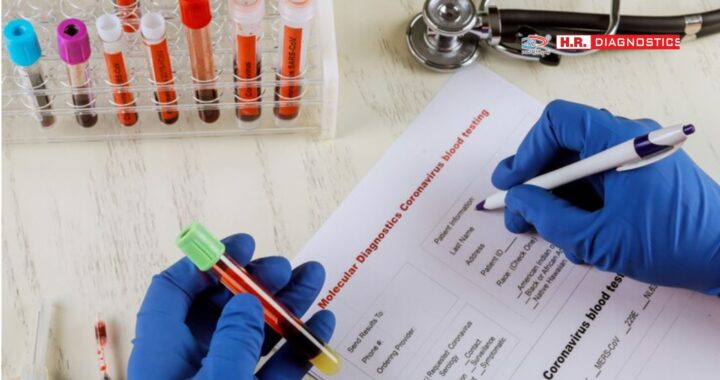 Human Chorionic Gonadotropin Test: Importance, Procedure & Benefits