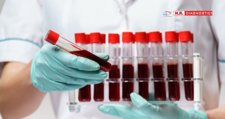 Importance of Blood Group Test for Your Health | H.R. Diagnostic