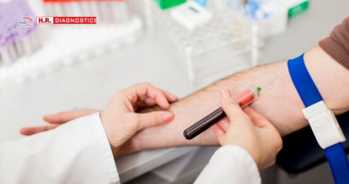 Find the Best Blood Test Centre Near Me for Accurate Results