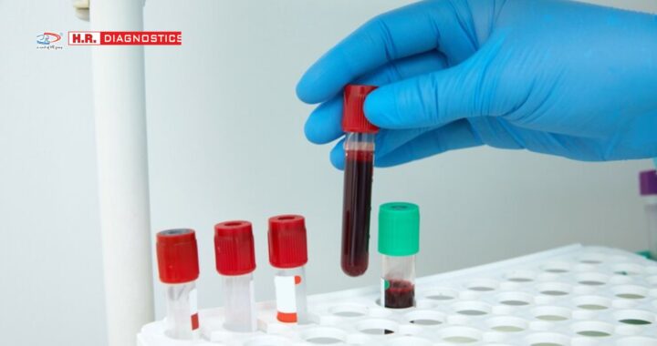 Find the Nearest Blood Test Lab for Accurate and Quick Results | H.R. Diagnostic