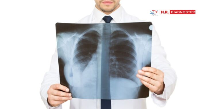 Normal Chest X-Ray | Accurate Imaging at H.R. Diagnostic