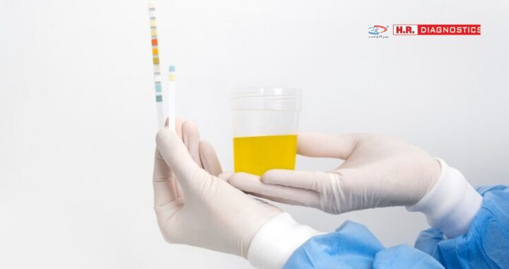 Urine Analysis: A Comprehensive Guide for Accurate Health Diagnosis