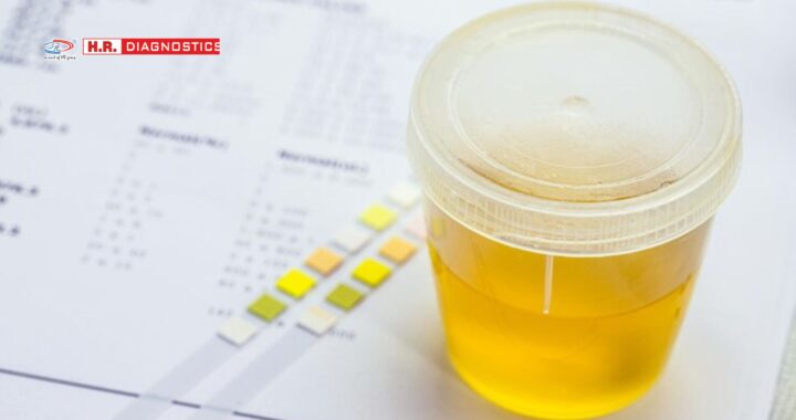 Complete Urine Examination for Health Monitoring | H.R. Diagnostic