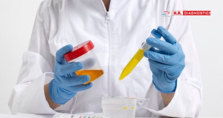 Comprehensive Guide to Urine Lab Test at H.R. Diagnostic | Book Now