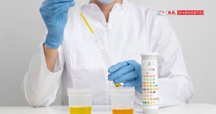 Comprehensive Urine Screening at H.R. Diagnostic – Accurate Results