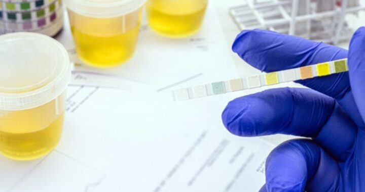 Urine Tests for Accurate Diagnosis at H.R. Diagnostic | Urinalysis