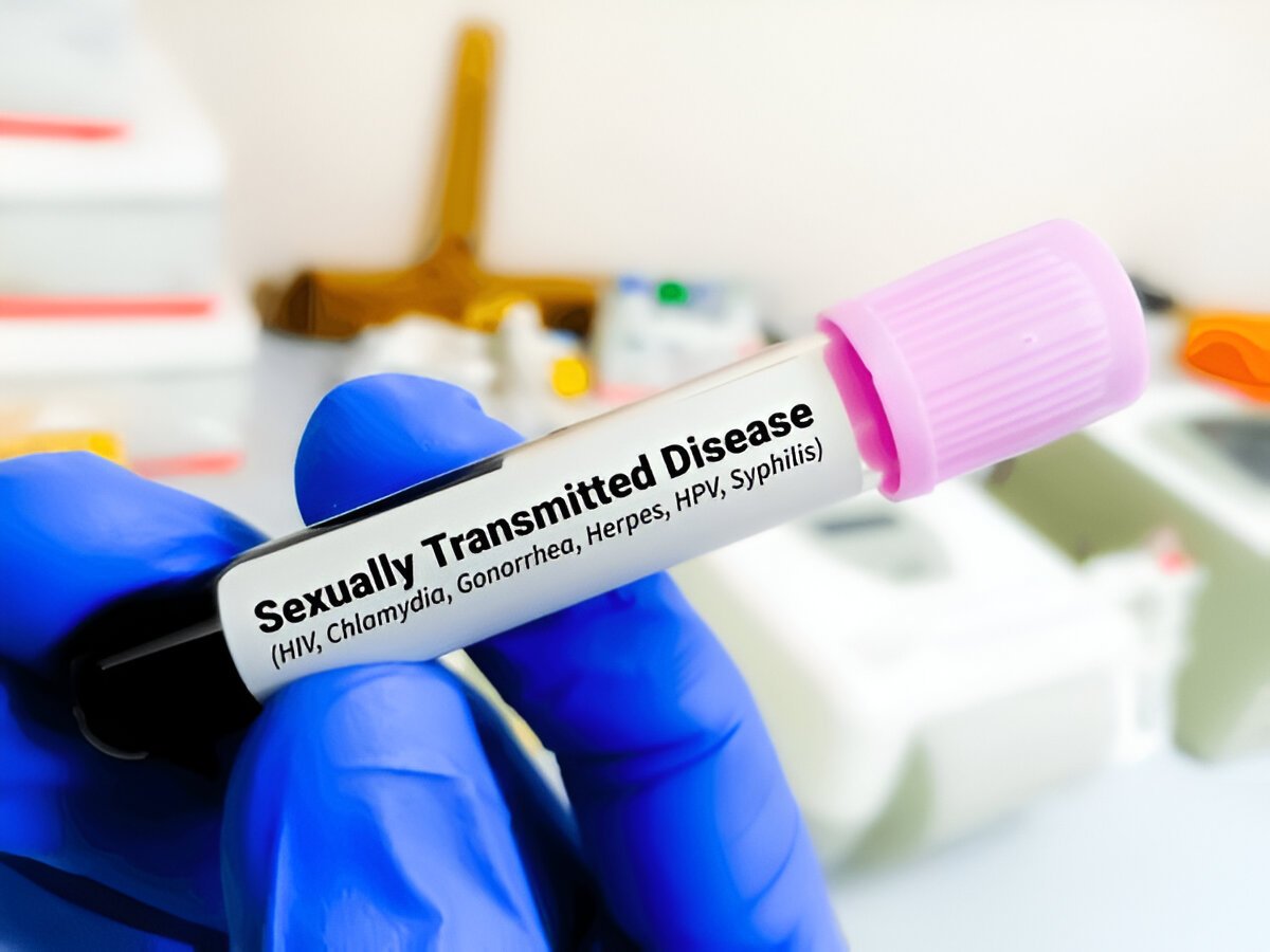 STD Test