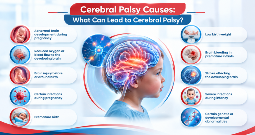 Cerebral Palsy Causes